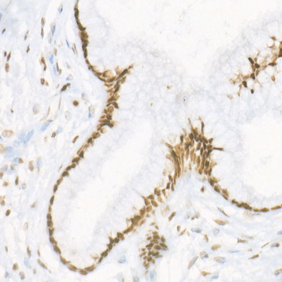 H3R17me2s Antibody in Immunohistochemistry (Paraffin) (IHC (P))