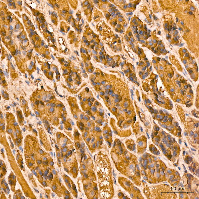 Luteinizing Hormone Antibody in Immunohistochemistry (Paraffin) (IHC (P))