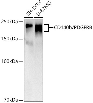PDGFRB Antibody in Western Blot (WB)