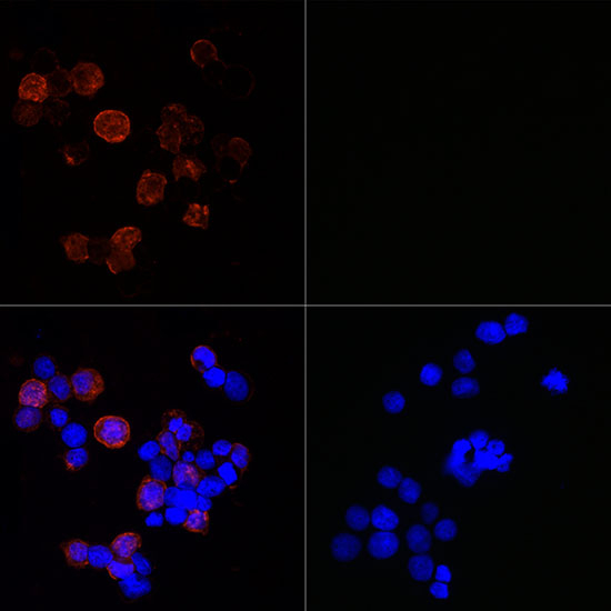 SARS-CoV-2 Nucleocapsid Antibody in Immunocytochemistry (ICC/IF)