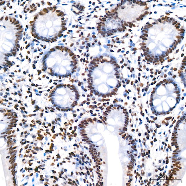 RBBP5 Antibody in Immunohistochemistry (Paraffin) (IHC (P))