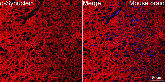 alpha Synuclein Antibody in Immunocytochemistry (ICC/IF)