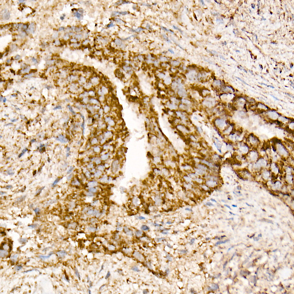 NDUFS1 Antibody in Immunohistochemistry (Paraffin) (IHC (P))
