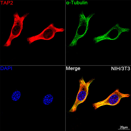 TAP2 Antibody in Immunocytochemistry (ICC/IF)