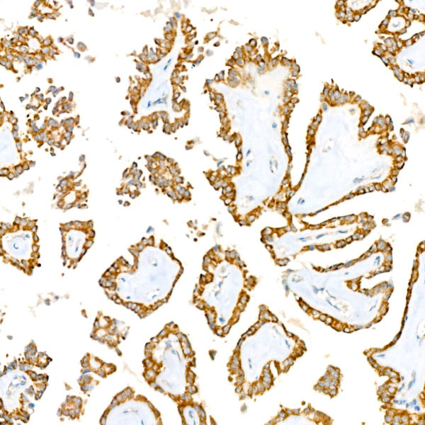 BCKDHB Antibody in Immunohistochemistry (Paraffin) (IHC (P))