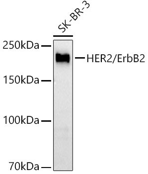 ErbB2 Antibody in Western Blot (WB)