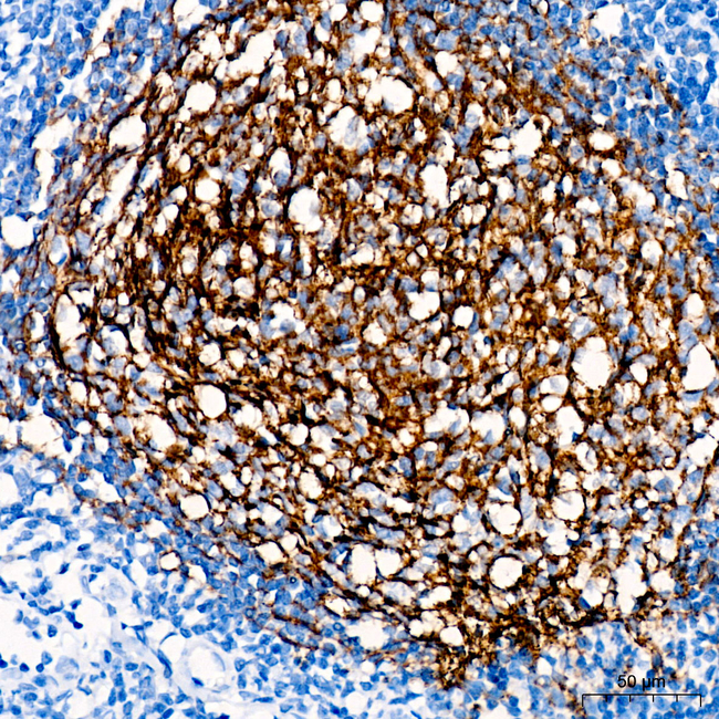 CD21 Antibody in Immunohistochemistry (Paraffin) (IHC (P))