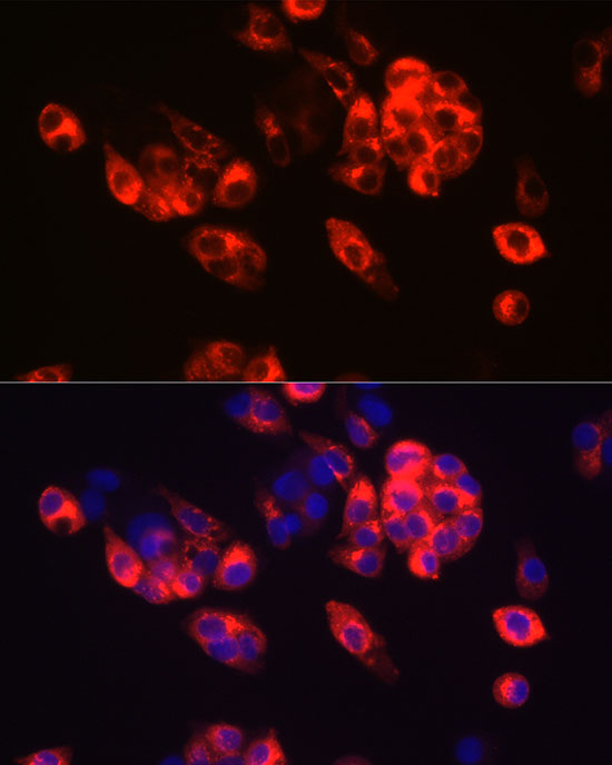 AFP Antibody in Immunocytochemistry (ICC/IF)