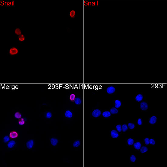 SNAIL Antibody in Immunocytochemistry (ICC/IF)
