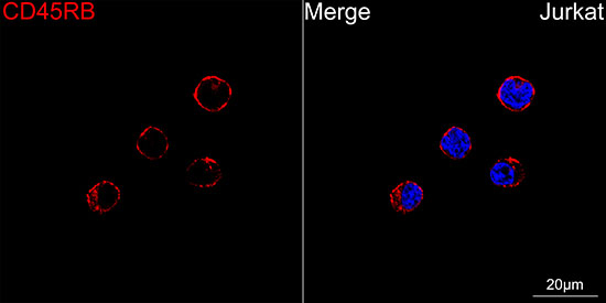CD45RB Antibody in Immunocytochemistry (ICC/IF)