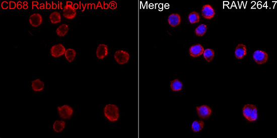 CD68 Antibody in Immunocytochemistry (ICC/IF)