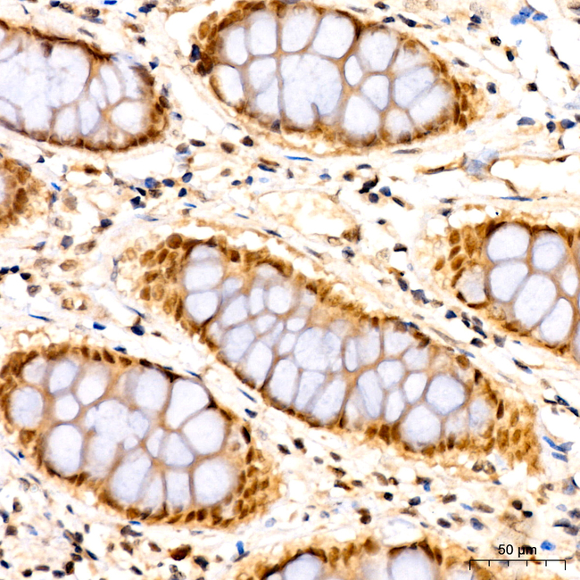 POLR2D Antibody in Immunohistochemistry (Paraffin) (IHC (P))
