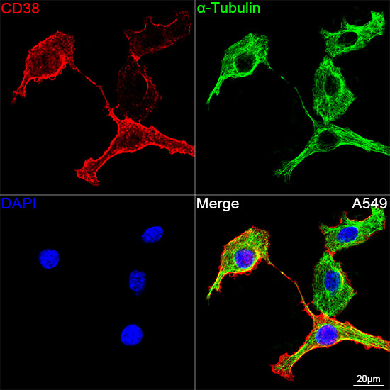 CD38 Antibody in Immunocytochemistry (ICC/IF)