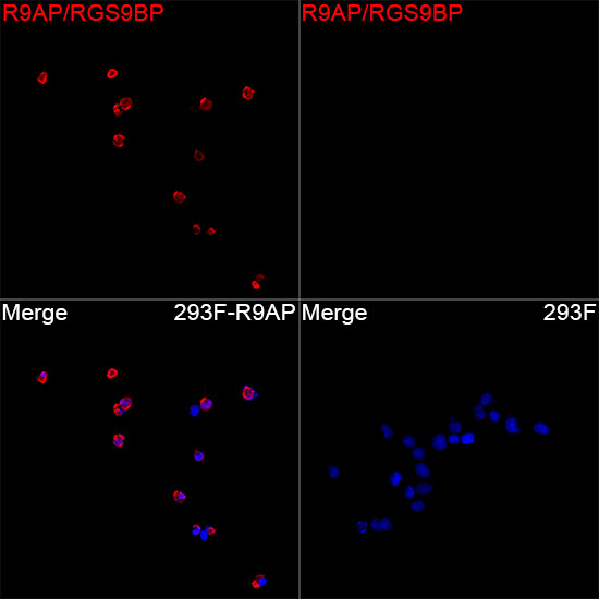 R9BP Antibody in Immunocytochemistry (ICC/IF)