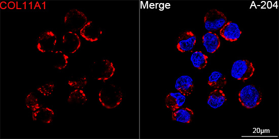 COL11A1 Antibody in Immunocytochemistry (ICC/IF)