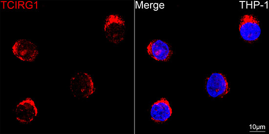 TCIRG1 Antibody in Immunocytochemistry (ICC/IF)