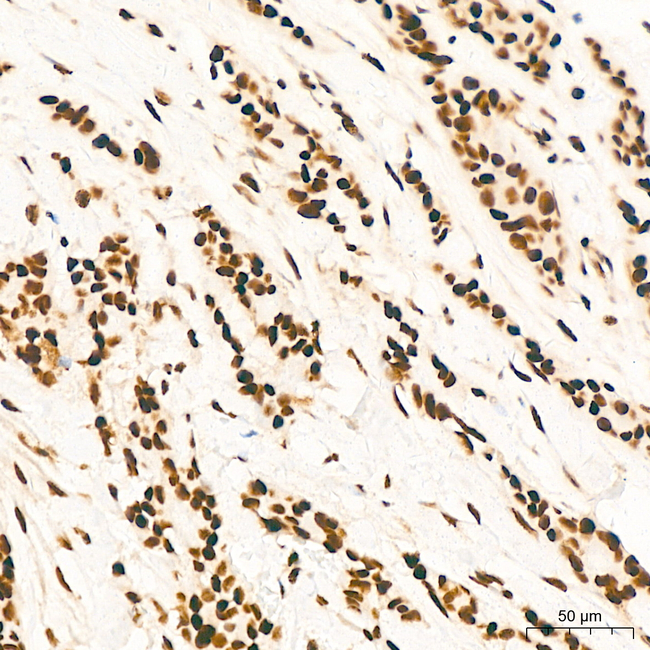 FTO Antibody in Immunohistochemistry (Paraffin) (IHC (P))