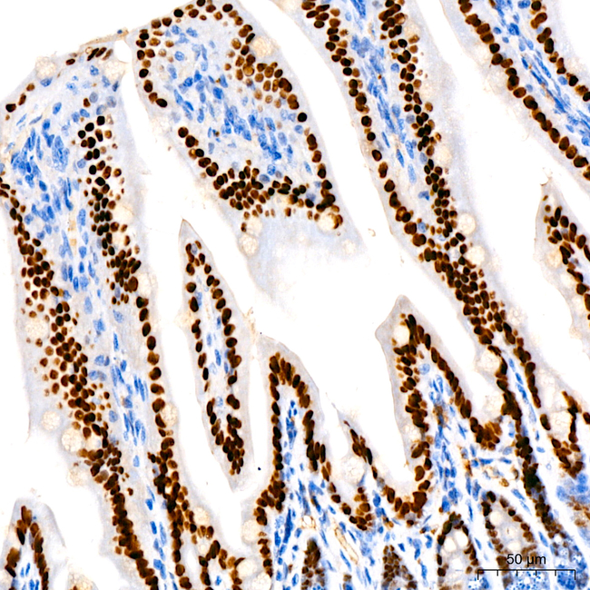 HNF4G Antibody in Immunohistochemistry (Paraffin) (IHC (P))