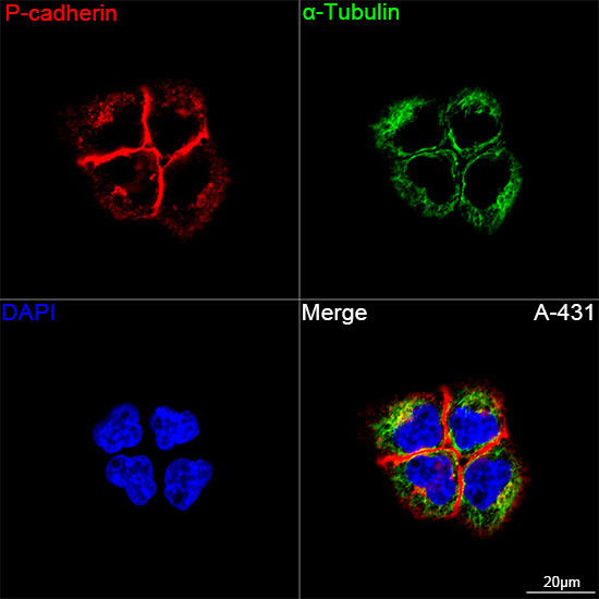 P-cadherin Antibody in Immunocytochemistry (ICC/IF)