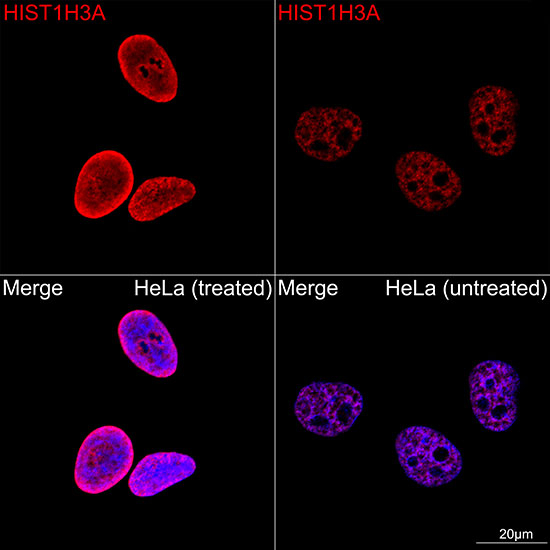 H3K18ac Antibody in Immunocytochemistry (ICC/IF)