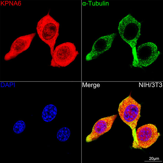 KPNA6 Antibody in Immunocytochemistry (ICC/IF)