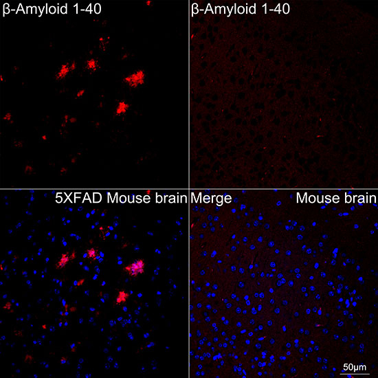beta Amyloid (1-40) Antibody in Immunohistochemistry (Paraffin) (IHC (P))