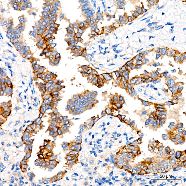 CD138 Antibody in Immunohistochemistry (Paraffin) (IHC (P))
