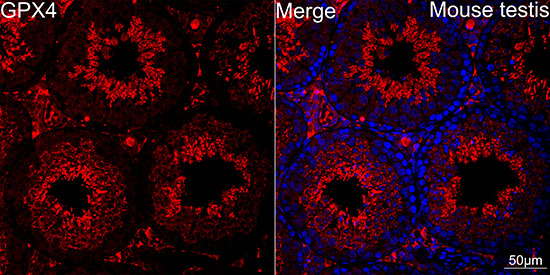 GPX4 Antibody in Immunohistochemistry (Paraffin) (IHC (P))