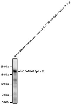 HCoV-NL63 Spike S2 Antibody in Western Blot (WB)