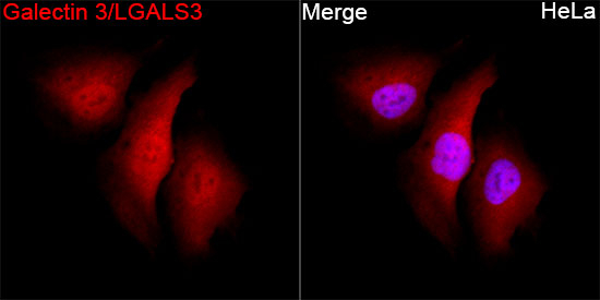 Galectin 3 Antibody in Immunocytochemistry (ICC/IF)