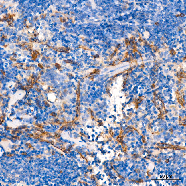 VE-cadherin Antibody in Immunohistochemistry (Paraffin) (IHC (P))