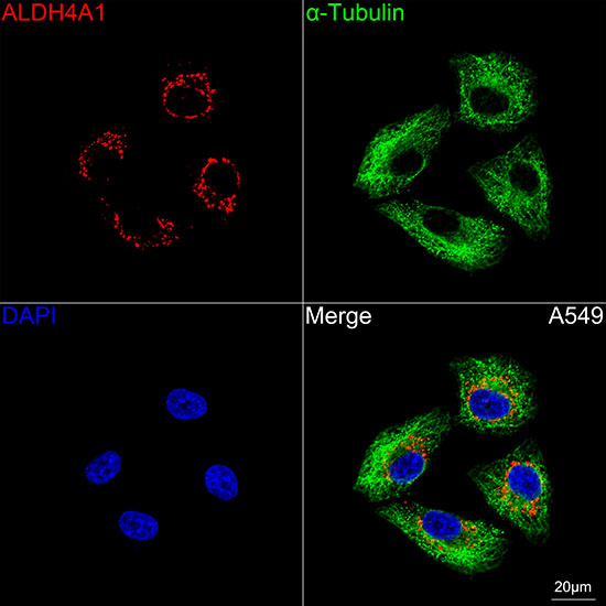 ALDH4A1 Antibody in Immunocytochemistry (ICC/IF)