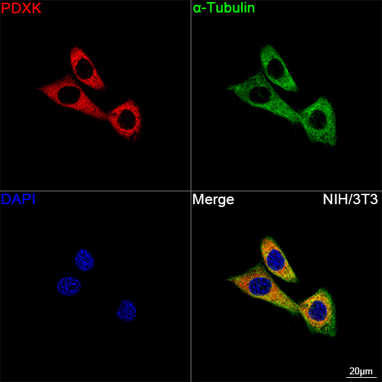 PDXK Antibody in Immunocytochemistry (ICC/IF)