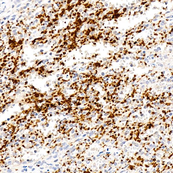 CD42a Antibody in Immunohistochemistry (Paraffin) (IHC (P))