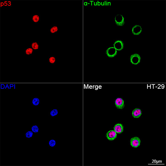 p53 Antibody in Immunocytochemistry (ICC/IF)