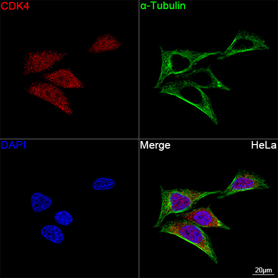 CDK4 Antibody in Immunocytochemistry (ICC/IF)