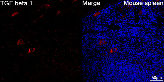 TGF beta-1 Antibody in Immunohistochemistry (Paraffin) (IHC (P))