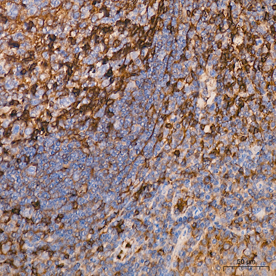 alpha Actinin 1 Antibody in Immunohistochemistry (Paraffin) (IHC (P))