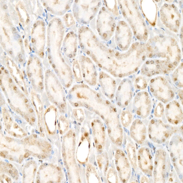 TLE2 Antibody in Immunohistochemistry (Paraffin) (IHC (P))
