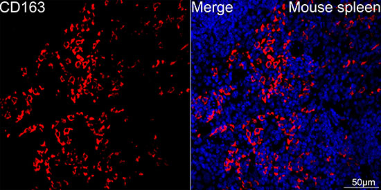 CD163 Antibody in Immunohistochemistry (Paraffin) (IHC (P))