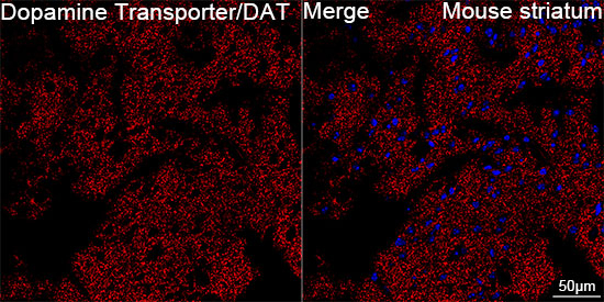Dopamine Transporter Antibody in Immunohistochemistry (Paraffin) (IHC (P))