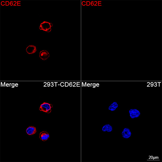 E-selectin Antibody in Immunocytochemistry (ICC/IF)