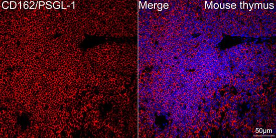 CD162 Antibody in Immunohistochemistry (Paraffin) (IHC (P))
