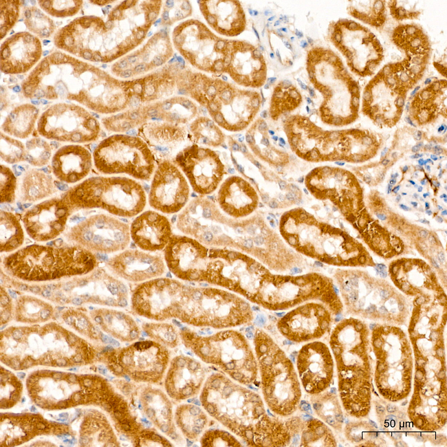 ACAA2 Antibody in Immunohistochemistry (Paraffin) (IHC (P))