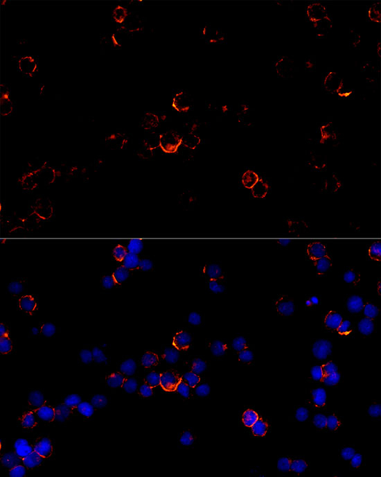 CD79b Antibody in Immunocytochemistry (ICC/IF)