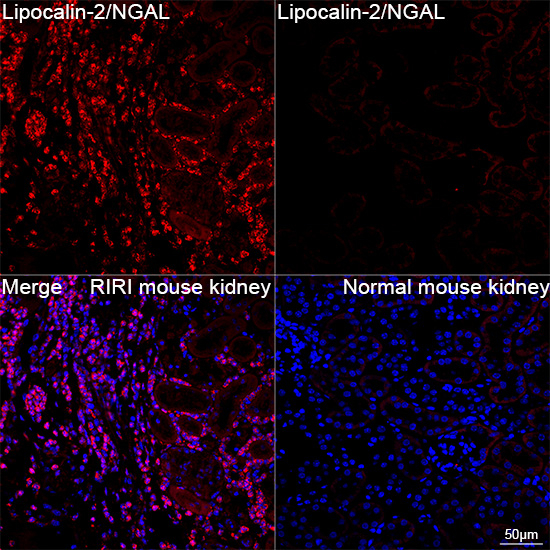 NGAL Antibody in Immunohistochemistry (Paraffin) (IHC (P))