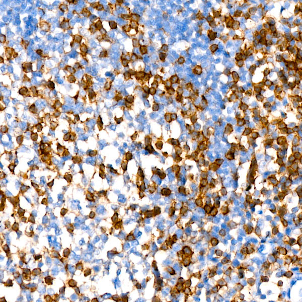 CD2 Antibody in Immunohistochemistry (Paraffin) (IHC (P))
