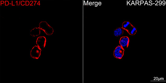 PD-L1 Antibody in Immunocytochemistry (ICC/IF)
