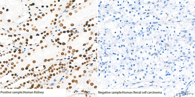 SETD2 Antibody in Immunohistochemistry (Paraffin) (IHC (P))