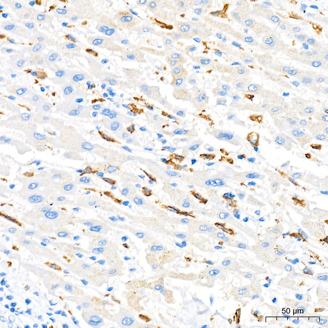 CD204 Antibody in Immunohistochemistry (Paraffin) (IHC (P))